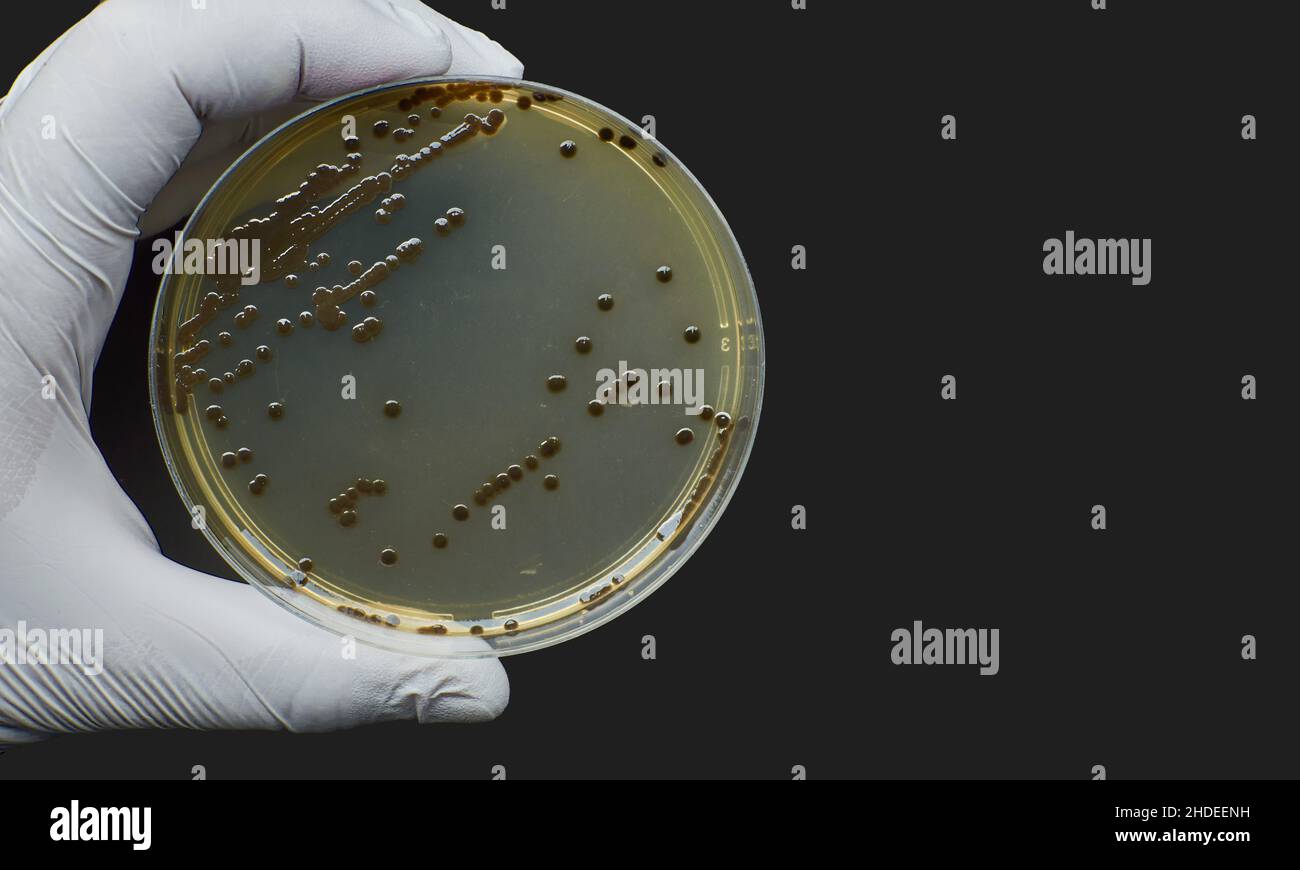 Black bacteria colonies on Selective media Agar Plates in petri dish