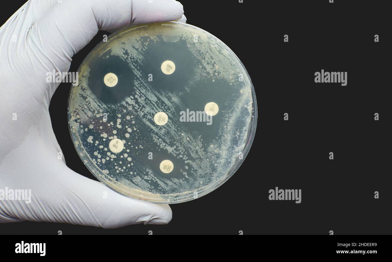 Antibiogram Kirby Bauer Antimicrobial susceptibility diffusion test  Stock Photo