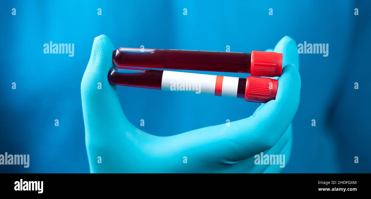 blood sample, blood collection, blood examination, blood test, blood