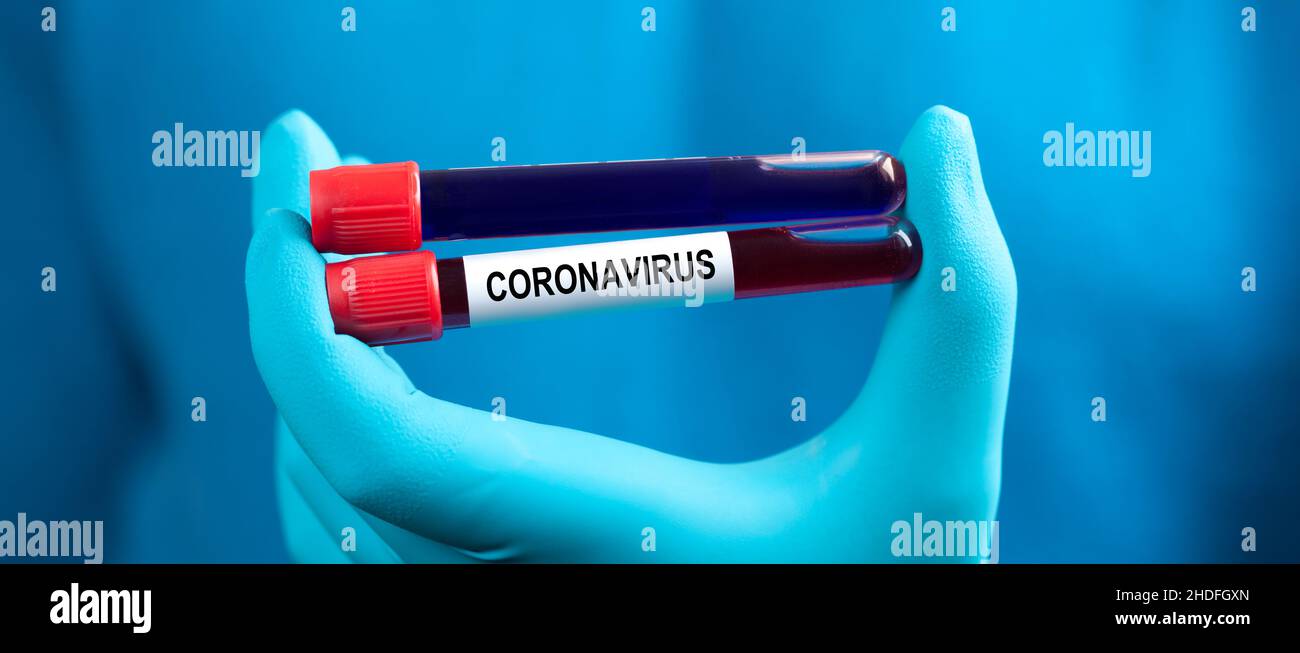 blood sample, blood collection, blood examination, blood test, corona