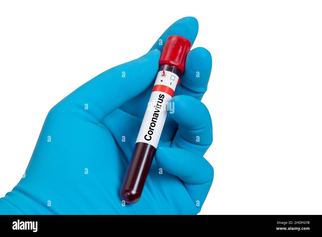 blood sample, blood examination, blood test, corona virus, blood