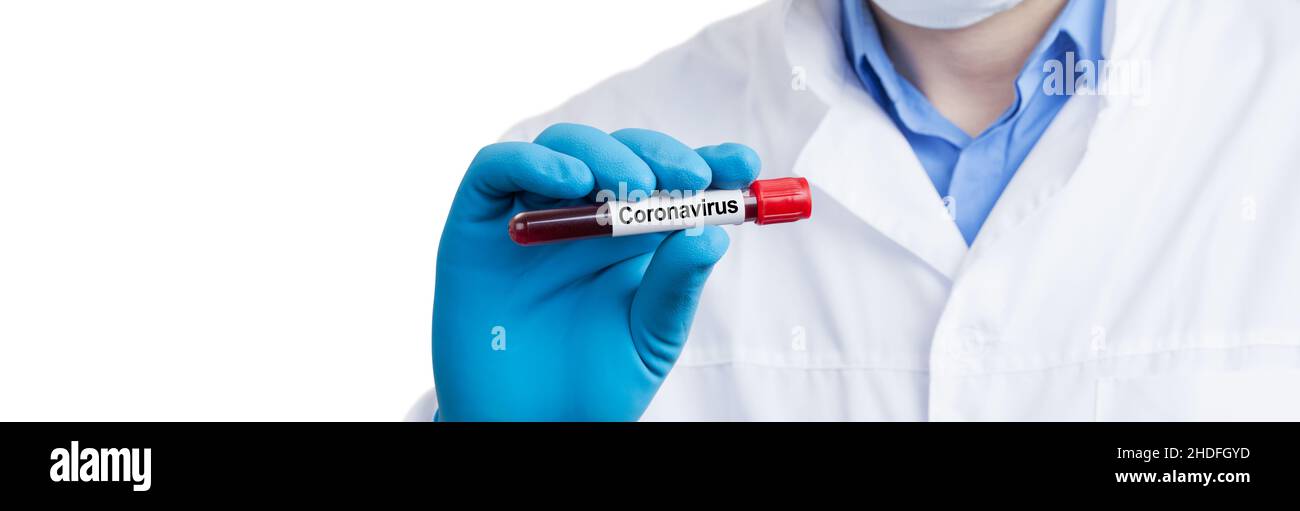 blood sample, blood examination, blood test, corona virus, blood
