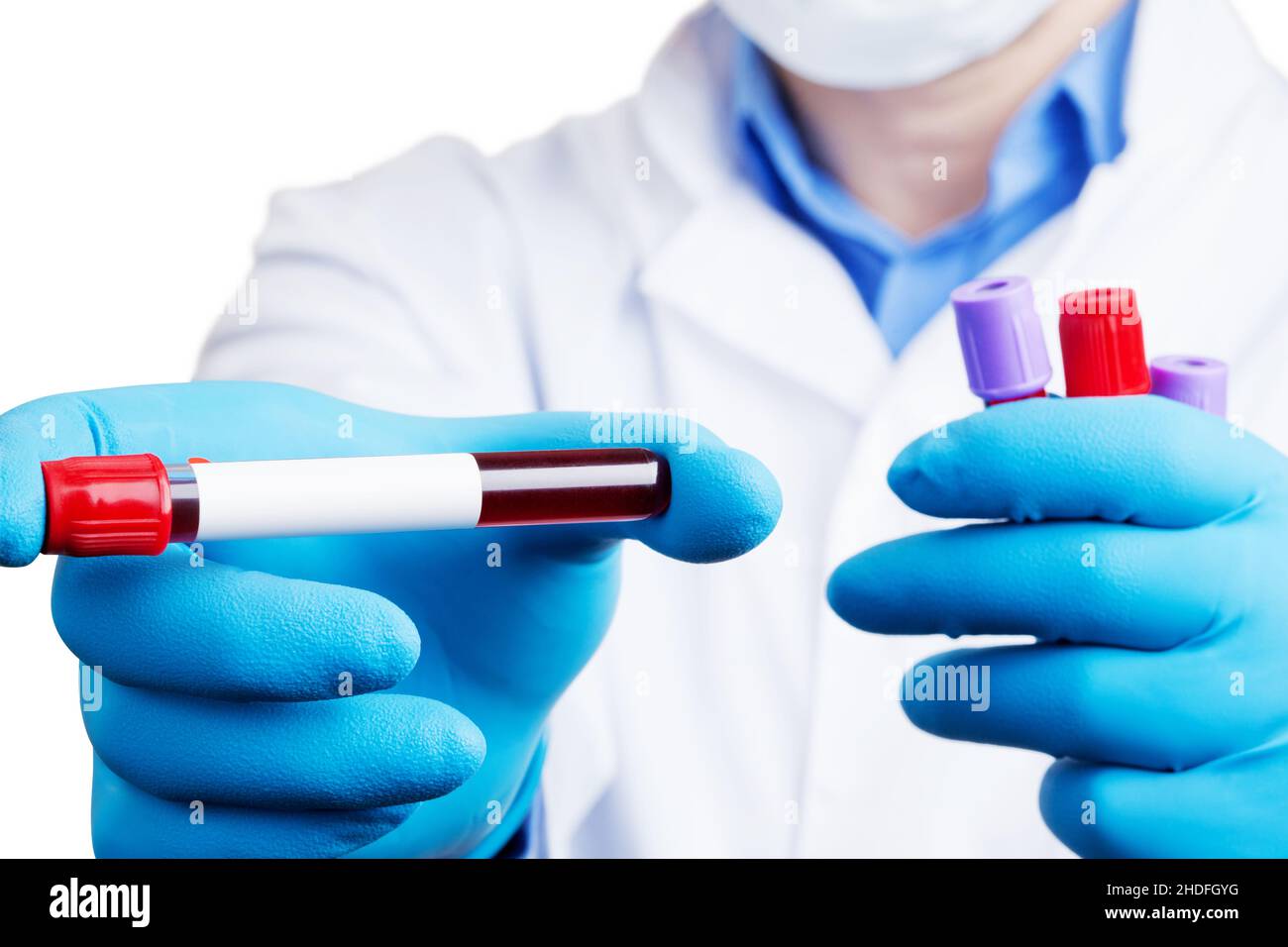 blood sample, blood examination, blood test, blood collection tube