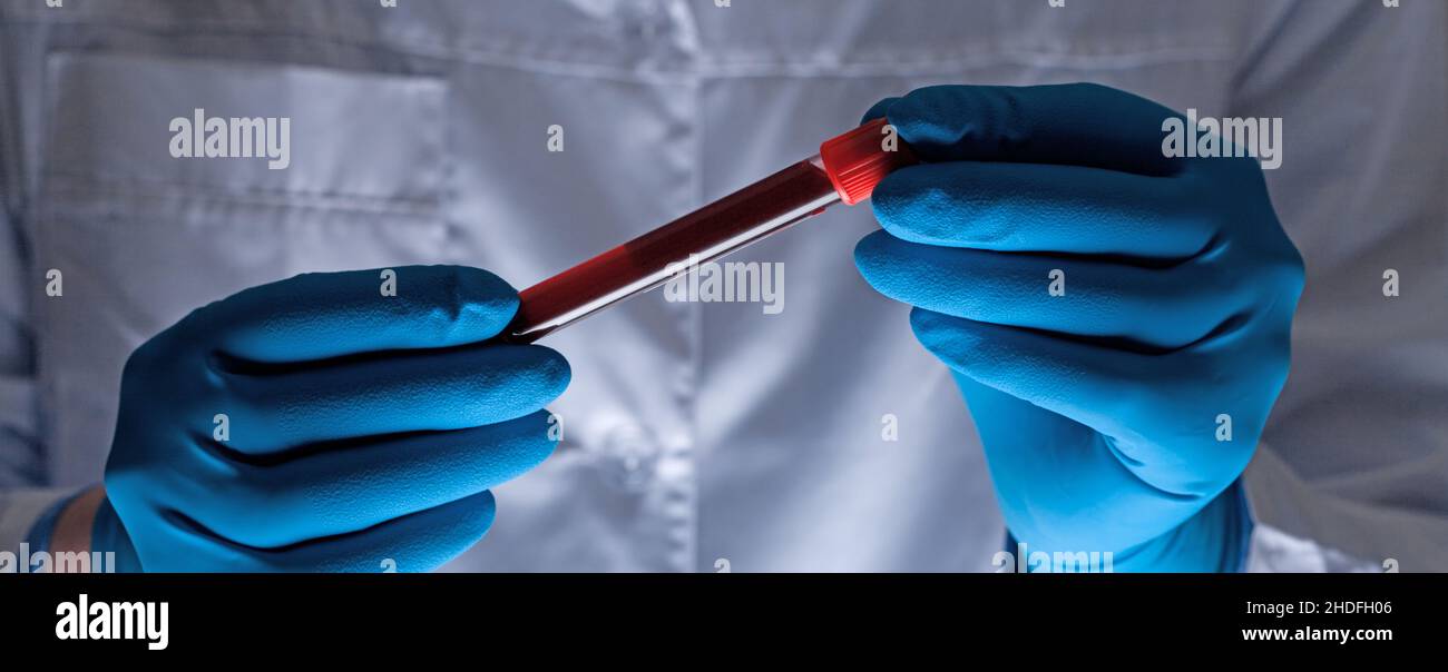 blood sample, blood examination, blood test, blood collection tube
