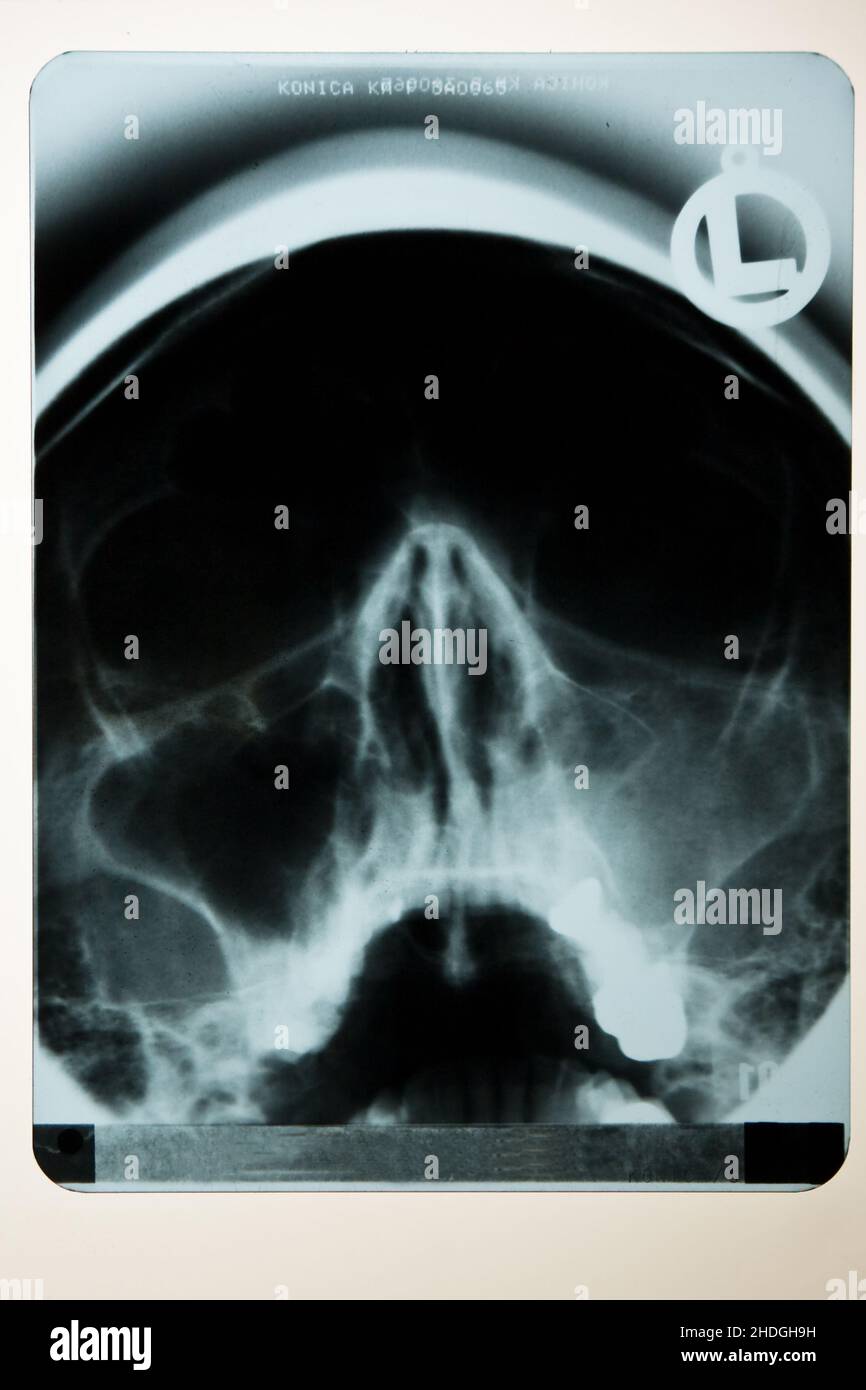 xray image, radiology, xrays, xray, xrays Stock Photo Alamy