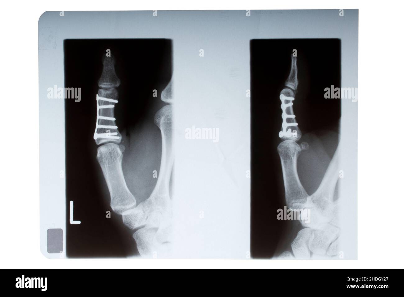 Radiologies Cut Out Stock Images & Pictures Alamy