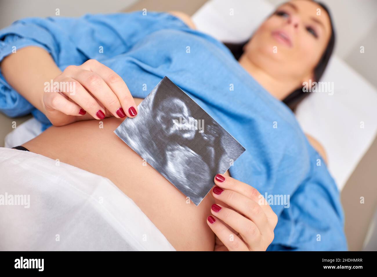 ultrasound, pregnancy, ultrasounds, pregnancies Stock Photo