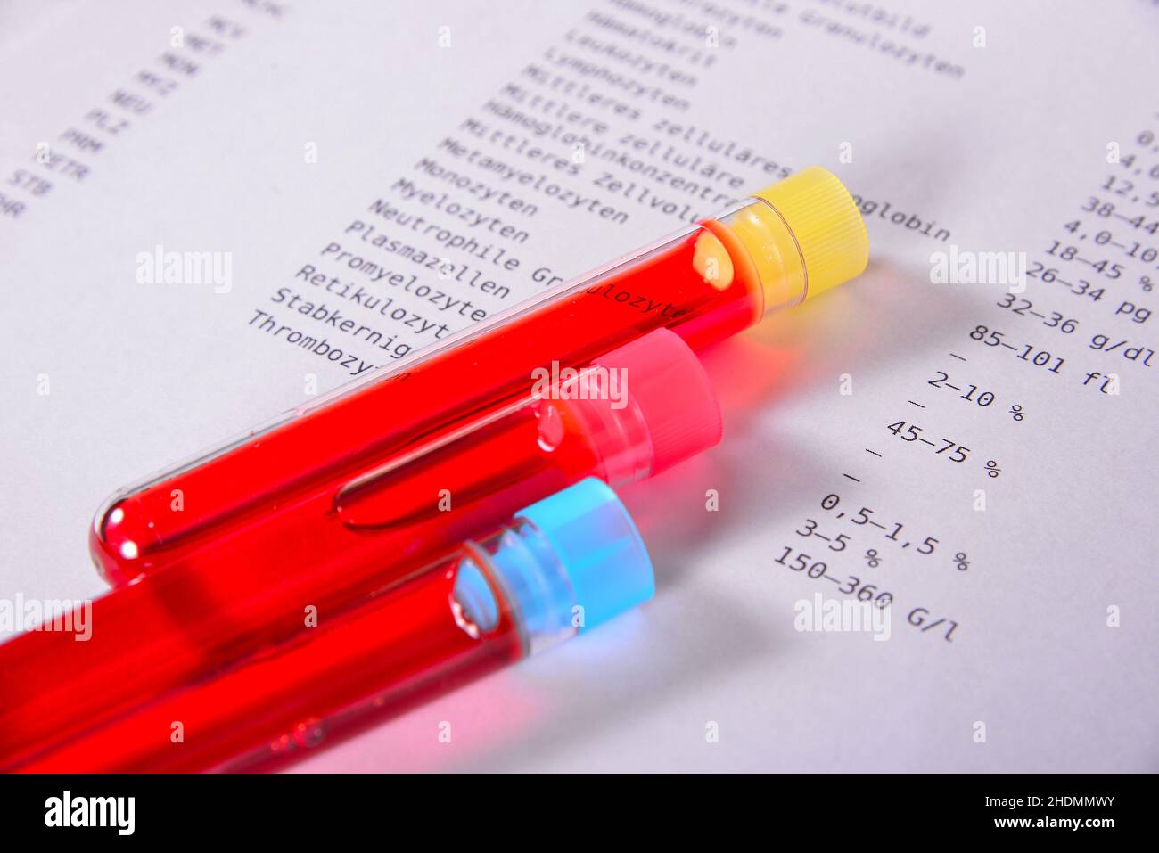 rehearsal, lab report, blood sample, rehearsals, lab reports, medical