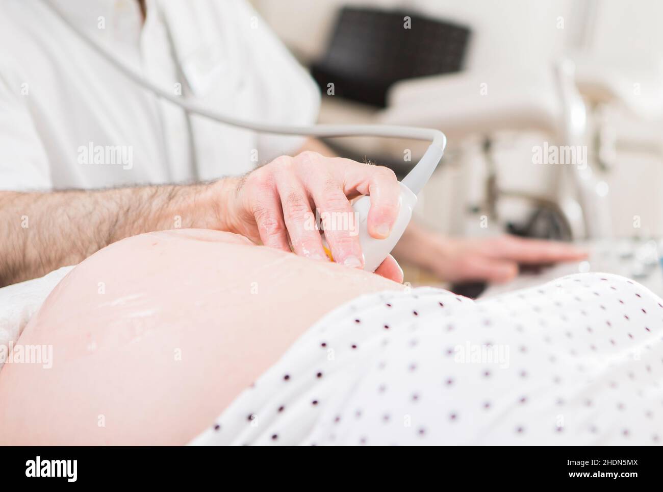 pregnancy, ultrasound, gynecology, pregnancies, ultrasounds