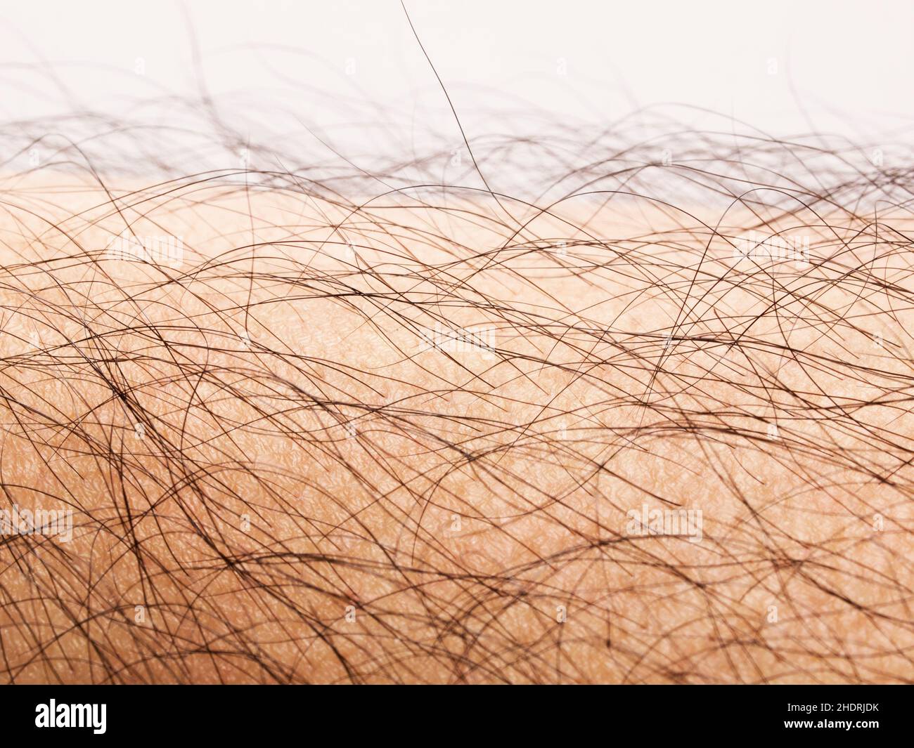 skin, hair, body hair, growth of hair, skins, hairs, body hairs Stock Photo