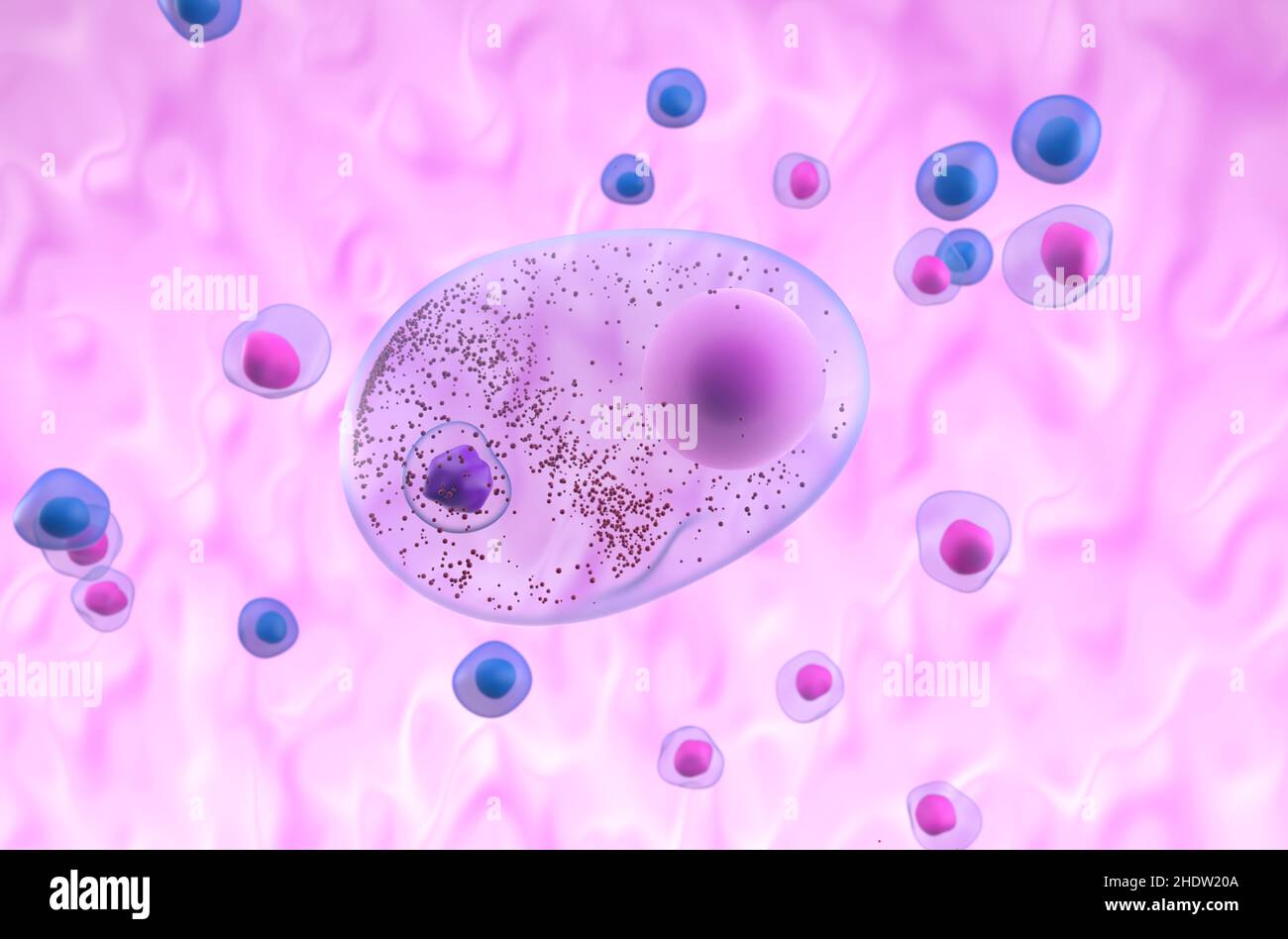 Lewy body in parkinson's disease (PD) or dementia (LBD) - isometric 3d