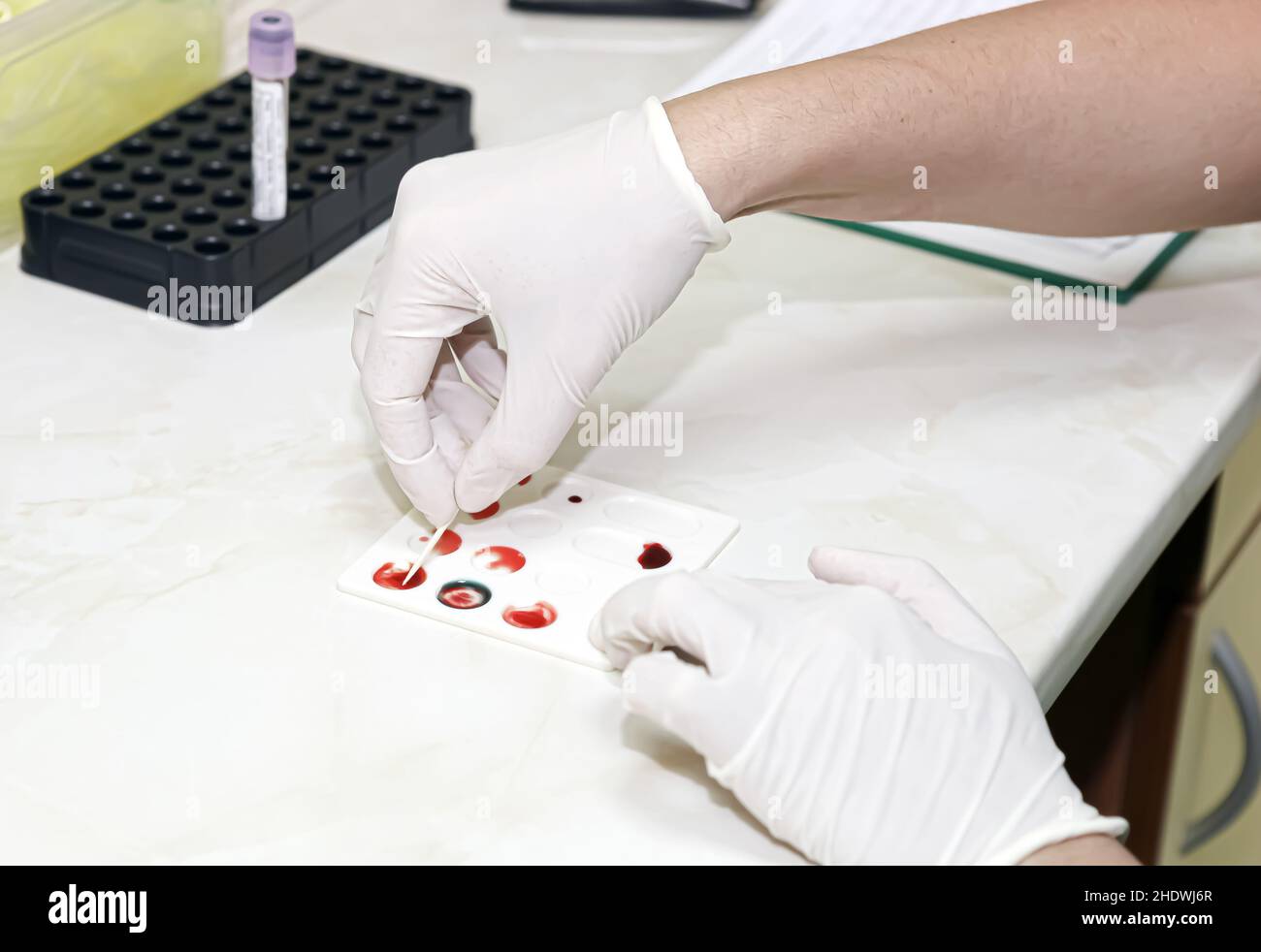 laboratory examination, diagnostic, blood sample, blood test