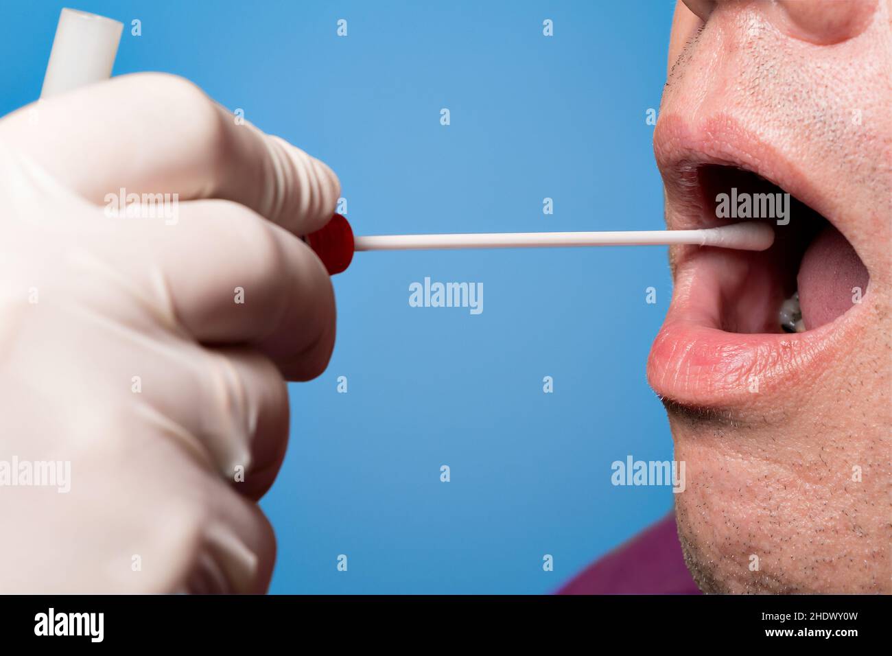 dna analysis, saliva sample, paternity, saliva samples, paternities dna analysis, saliva sample, paternity, saliva samples, paternities