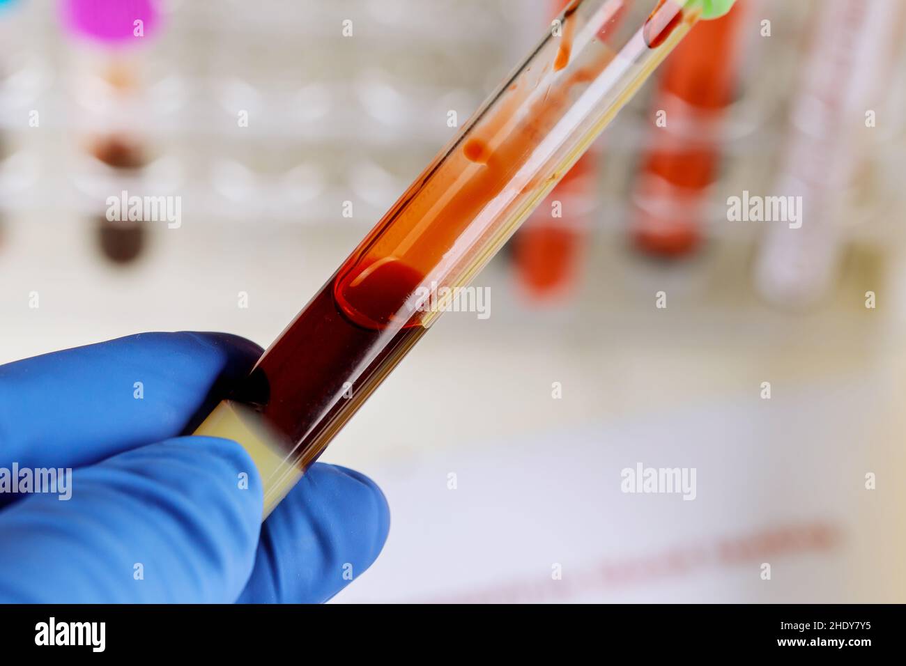 laboratory examination, blood sample, blood test, laboratory
