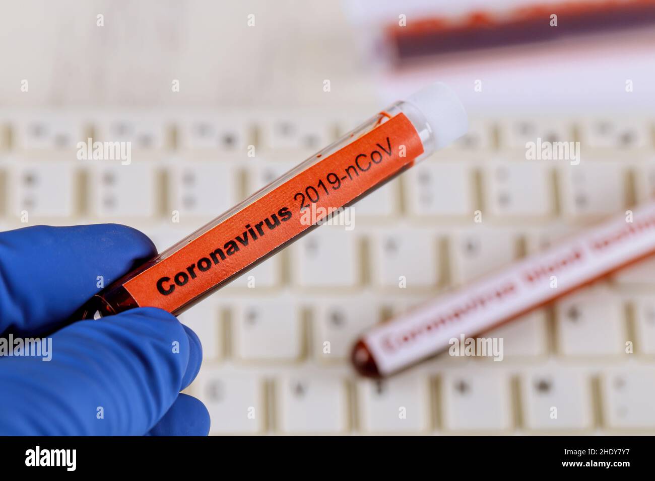 laboratory examination, diagnosis, blood test, corona virus, laboratory