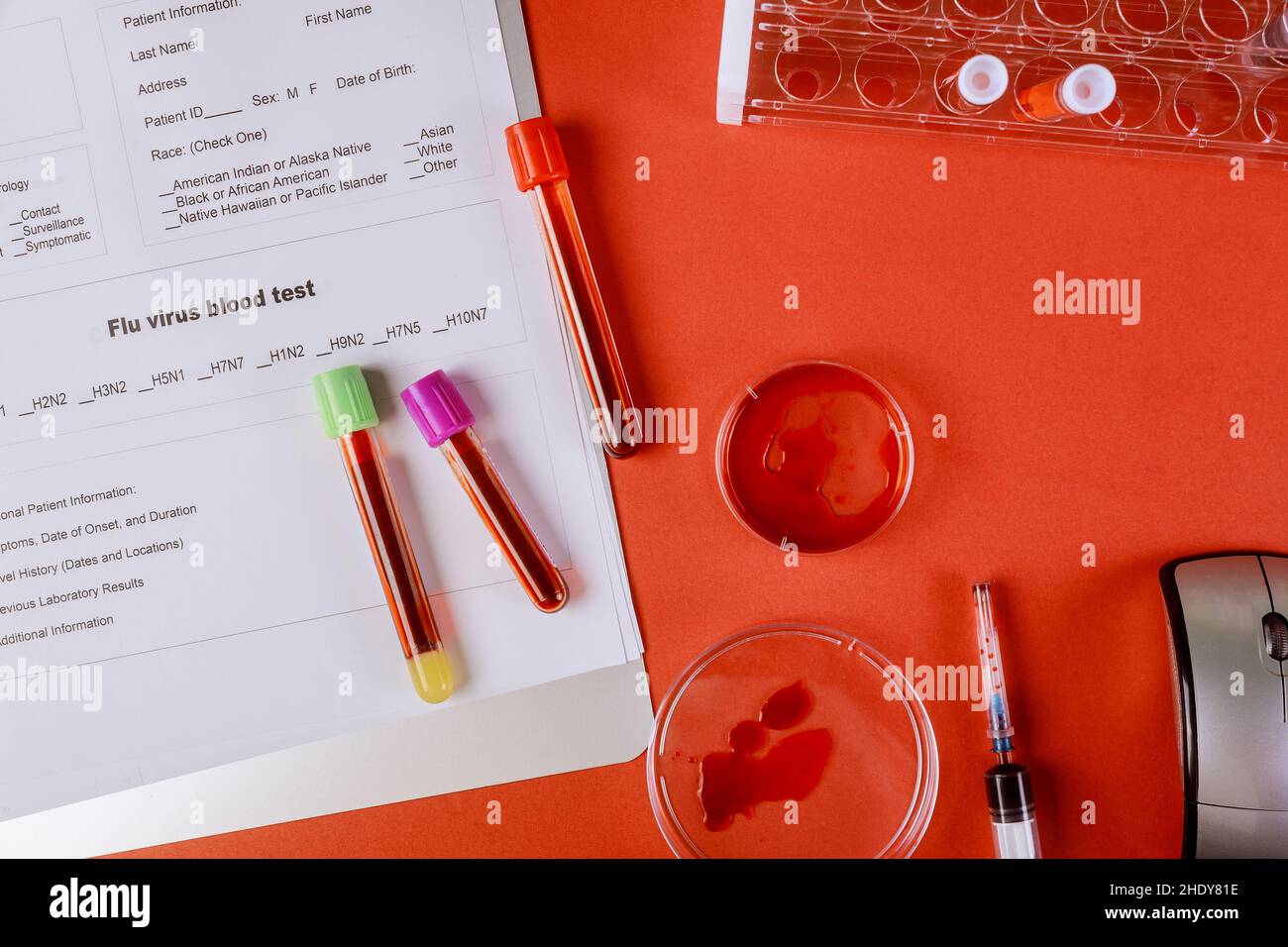 laboratory examination, blood sample, diagnosis, infection, laboratory
