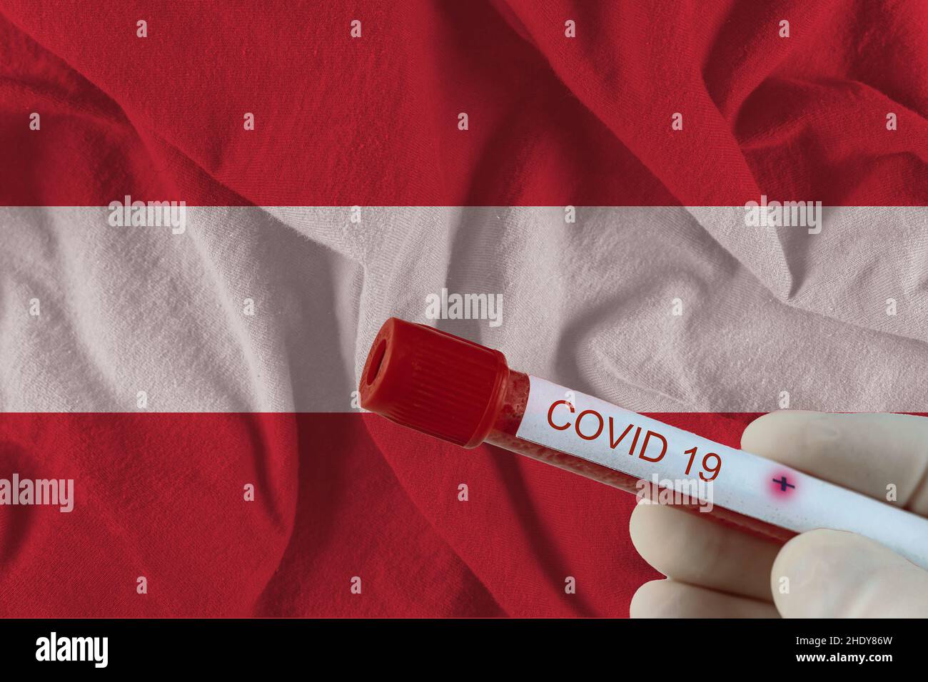 blood sample, covid19, blood samples Stock Photo Alamy