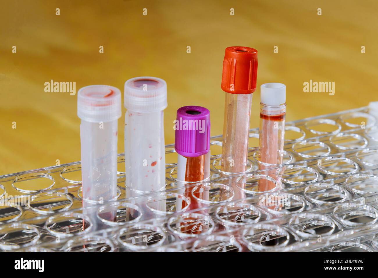 laboratory, blood sample, blood examination, laboratories, blood
