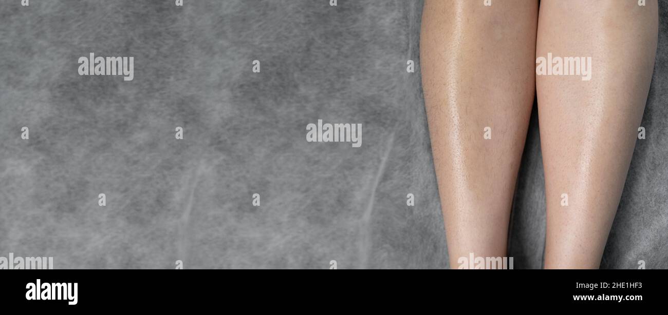 Image before and after concept of hair removal on female legs in a beauty salon. Baner. Stock Photo