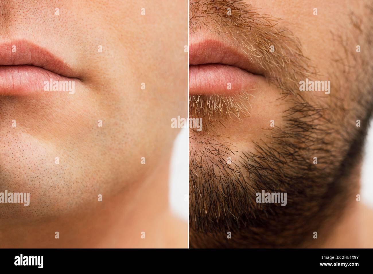 Close up photo of a man's face before and after shaving. a young man with a beard. Comparison of a man's face with a beard and without a beard. use of Stock Photo