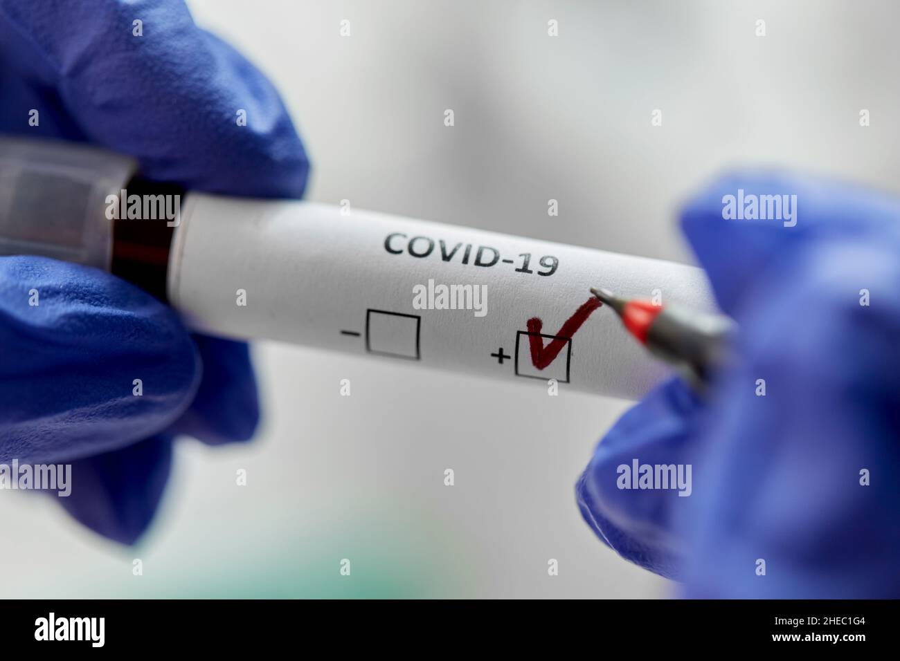 hand holding beaker with coronavirus blood test Stock Photo - Alamy