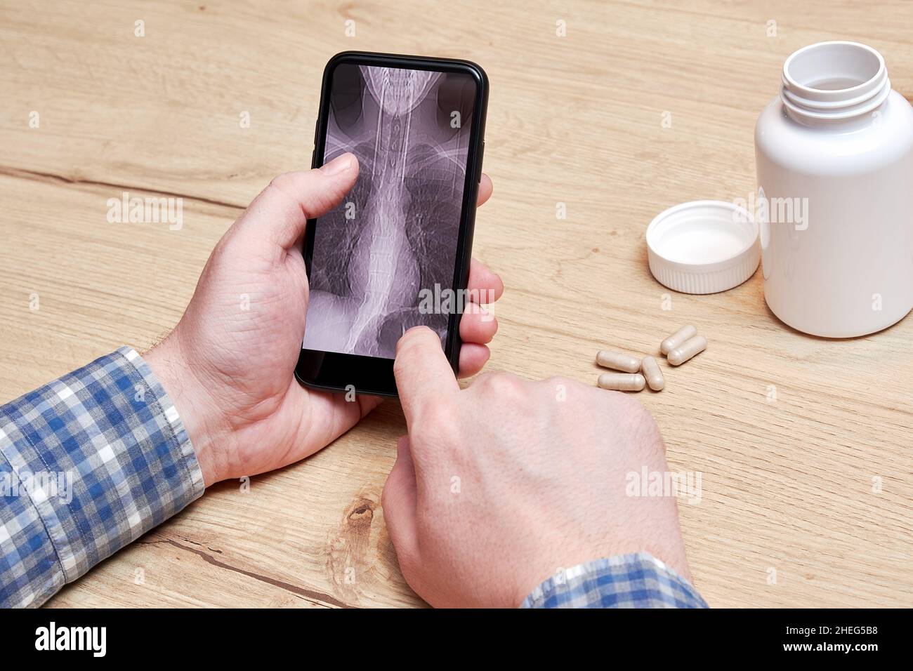 Old man analyzing his lungs CT scan on a phone. Pneumonia and disease diagnosis. Pills and medical bottles Stock Photo