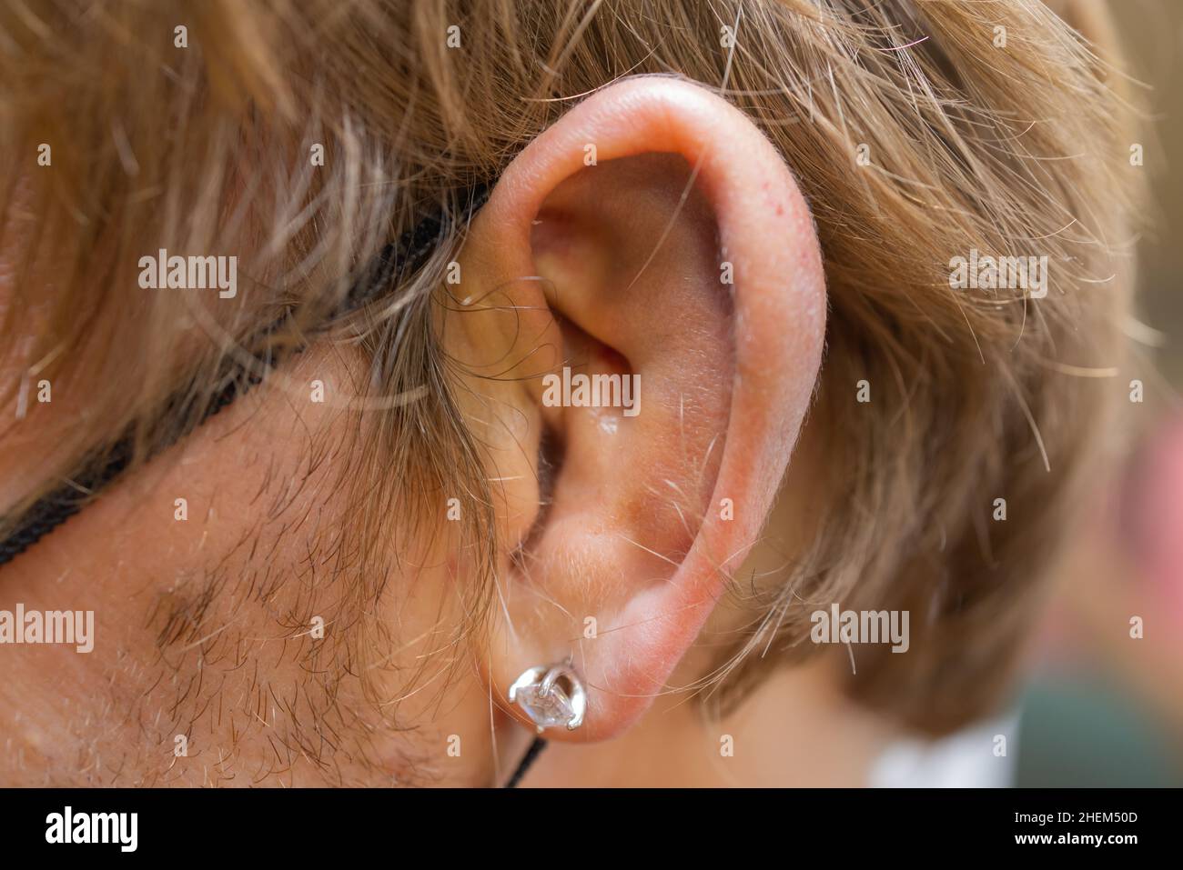 Ruptured eardrum hires stock photography and images Alamy