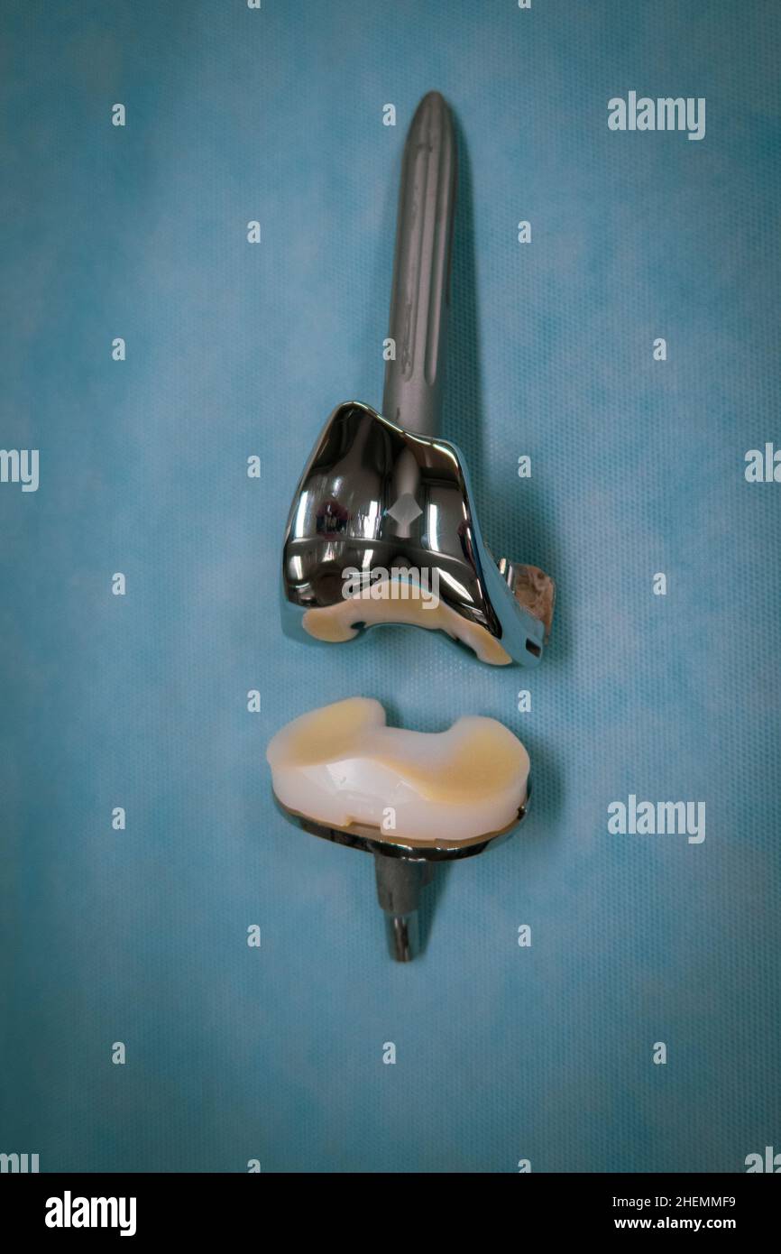 a complete explanted knee prosthesis consisting of distal and proximal ...