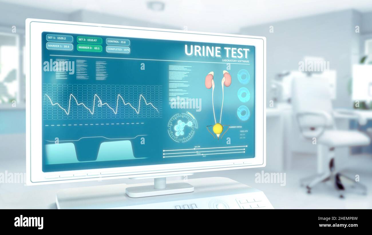 urinalysis on monitor in high tech hospital room . industrial 3D ...