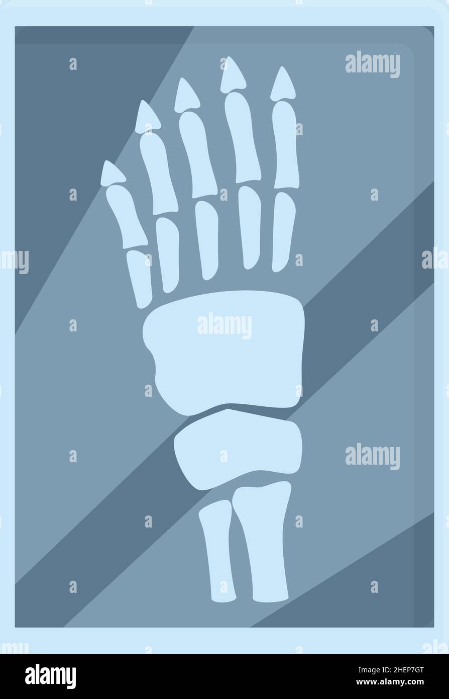 Xray hand scan icon cartoon vector. Bone test. Doctor radiology Stock Vector