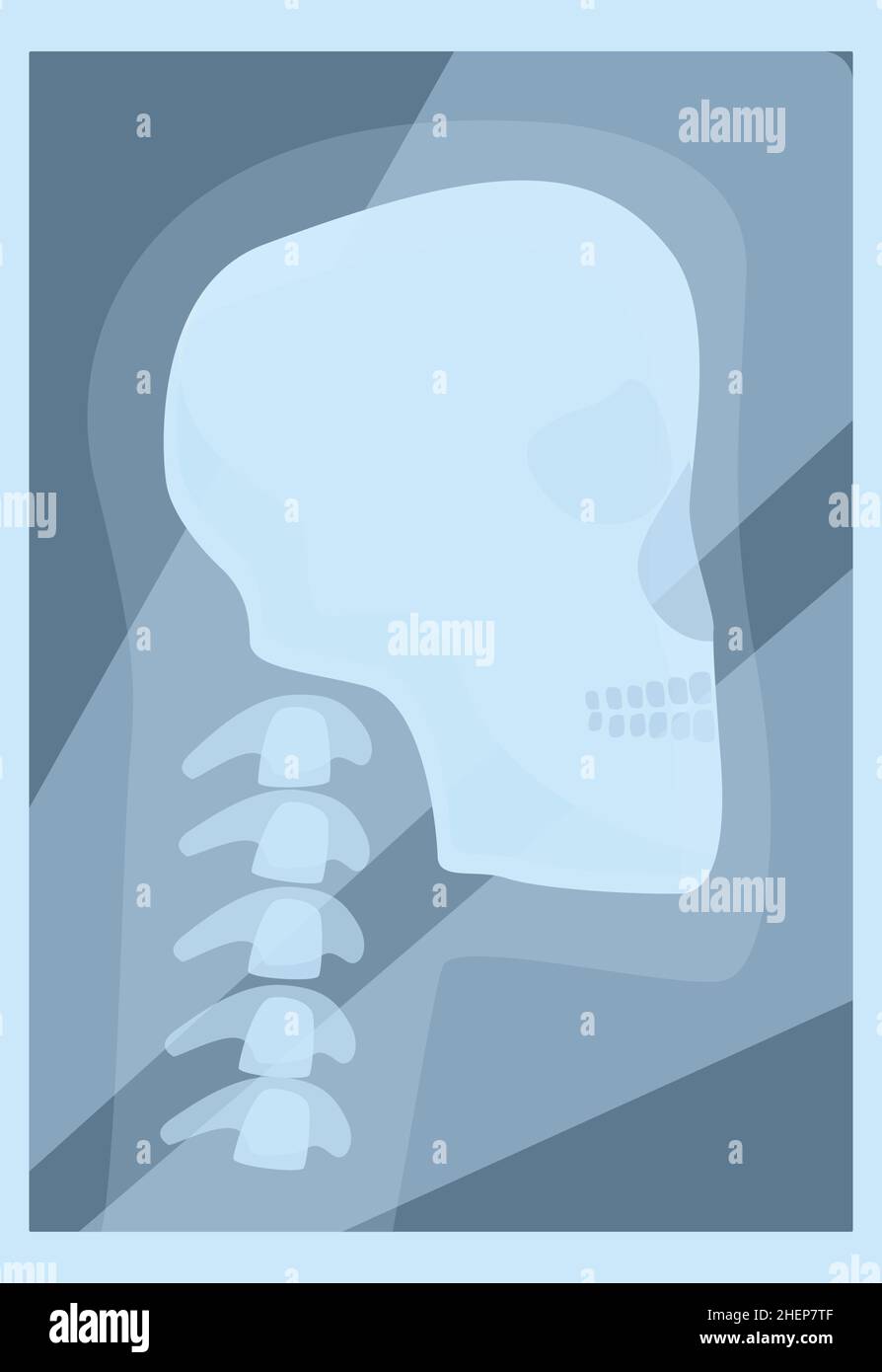 Xray shoulder scan icon cartoon vector. Medical machine. Health test Stock Vector