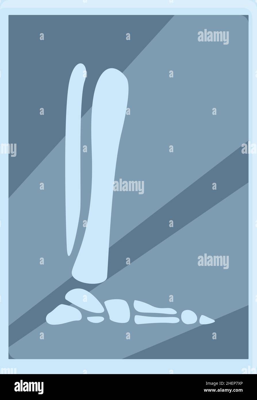 Xray foot scan icon cartoon vector. Bone machine. Medical health Stock Vector