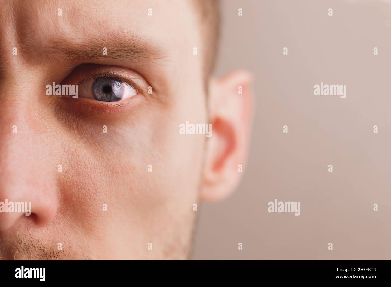 Young worried man with stern look. Sad expression. Close-up portrait half face. Mental health Stock Photo