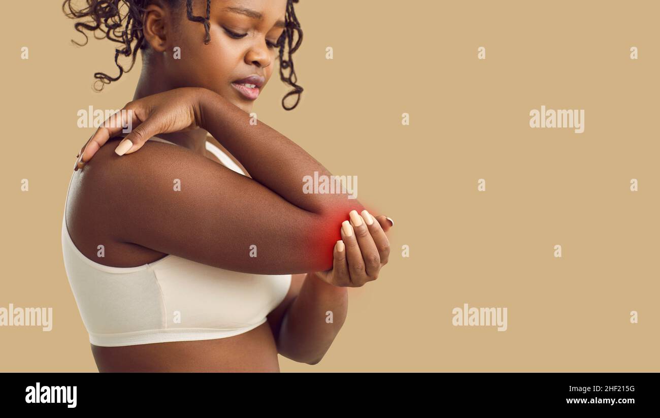 Unhealthy African American woman have pain in elbow Stock Photo