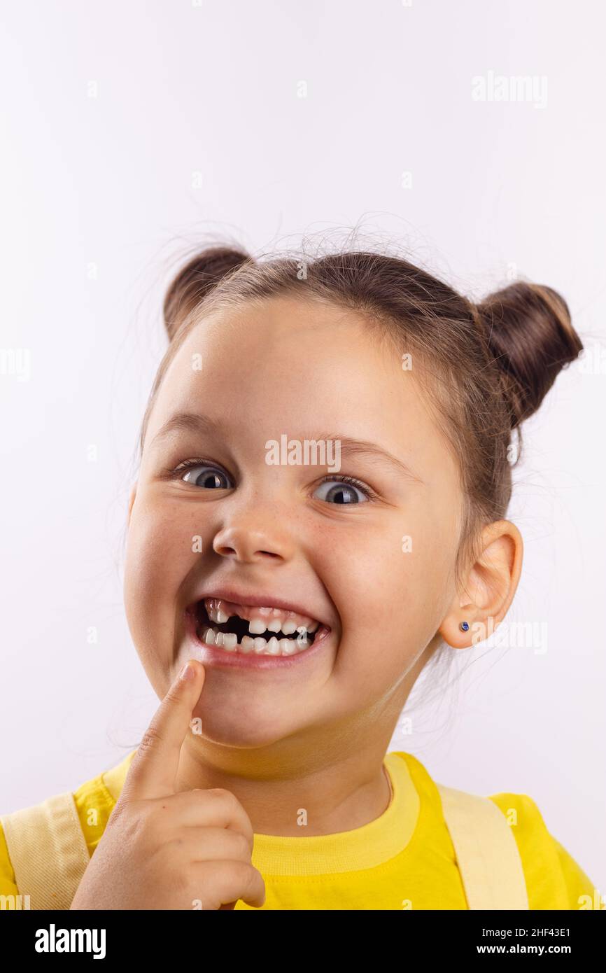 Pretty girl with opened mouth pointing at missing front milk tooth with finger smiling crazily and looking at camera on white background. First teeth Stock Photo