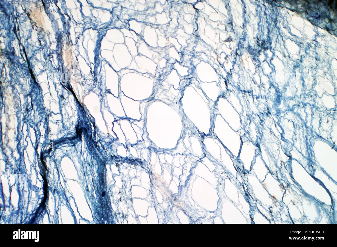 Areolar connective tissue, light micrograph Stock Photo