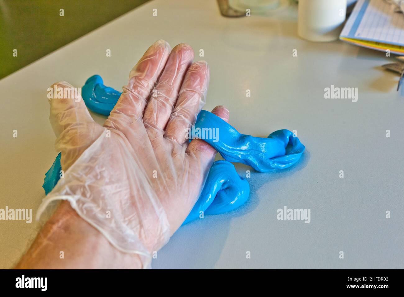 hand physiotherapy to recover a broken finger Stock Photo Alamy