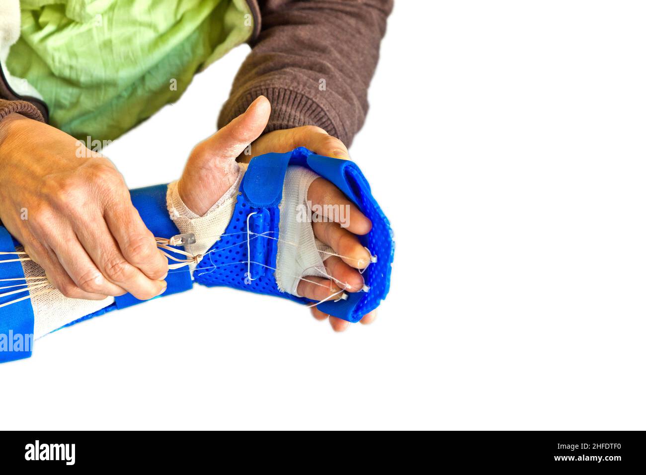 hand physiotherapy to recover a broken finger Stock Photo Alamy