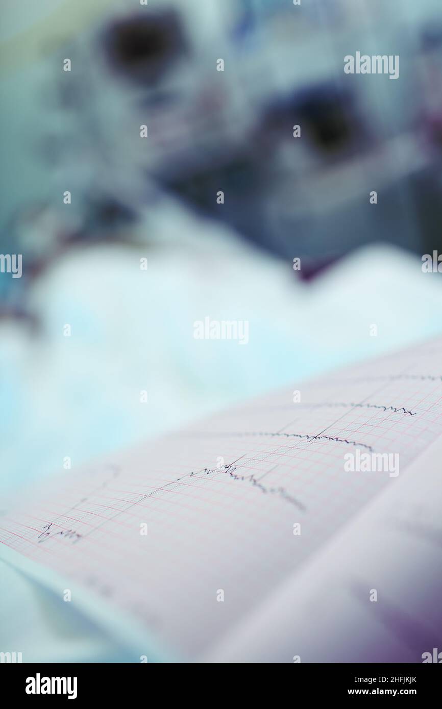 ECG chart with rippled heart line on the blurred bed with lying patient. Stock Photo