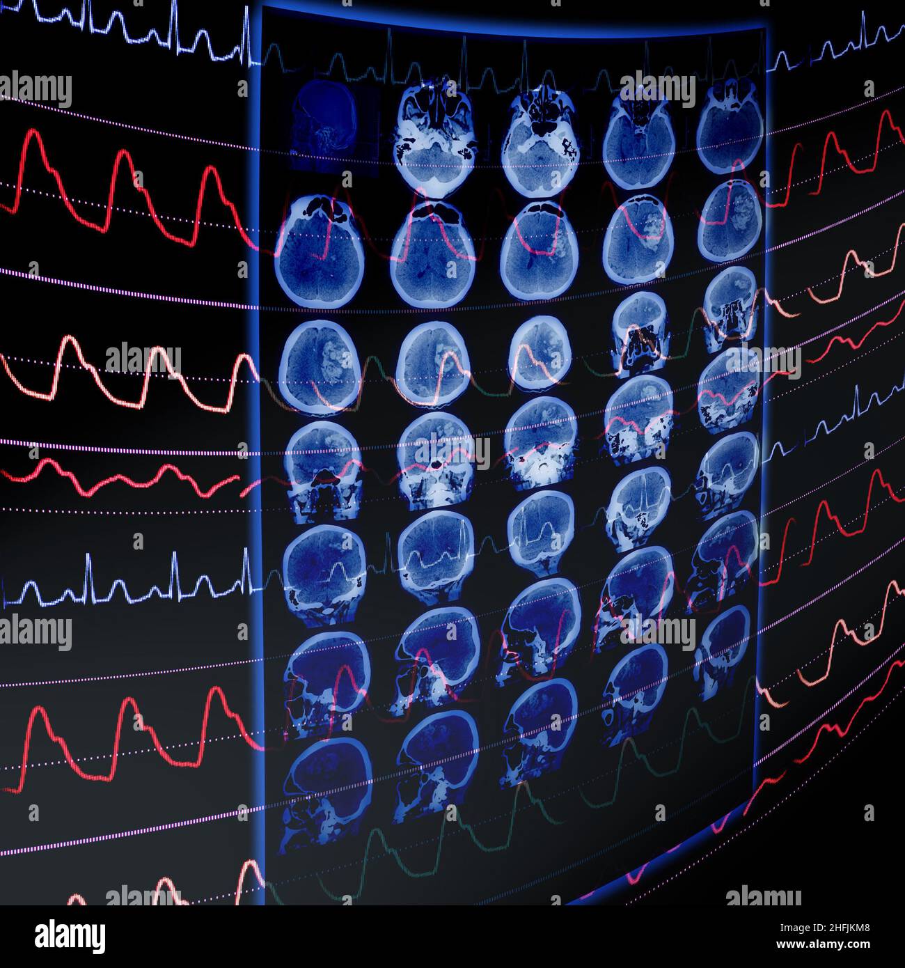 CT film and ECG monitoring as a medical concept of early vascular disease detection. Stock Photo
