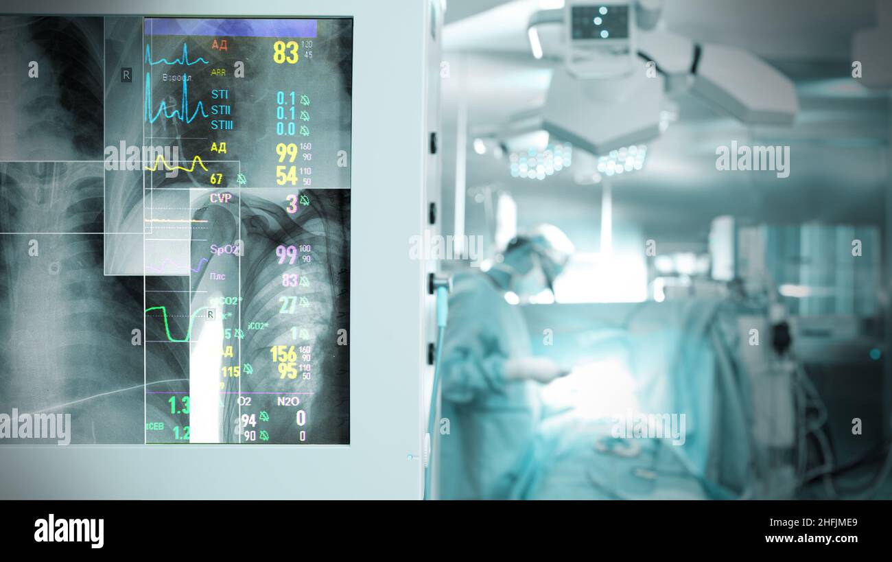 X-ray monitoring of patient thorax during surgery. Monitor with roentgen image and heart rate on the background of working surgeon. Stock Photo