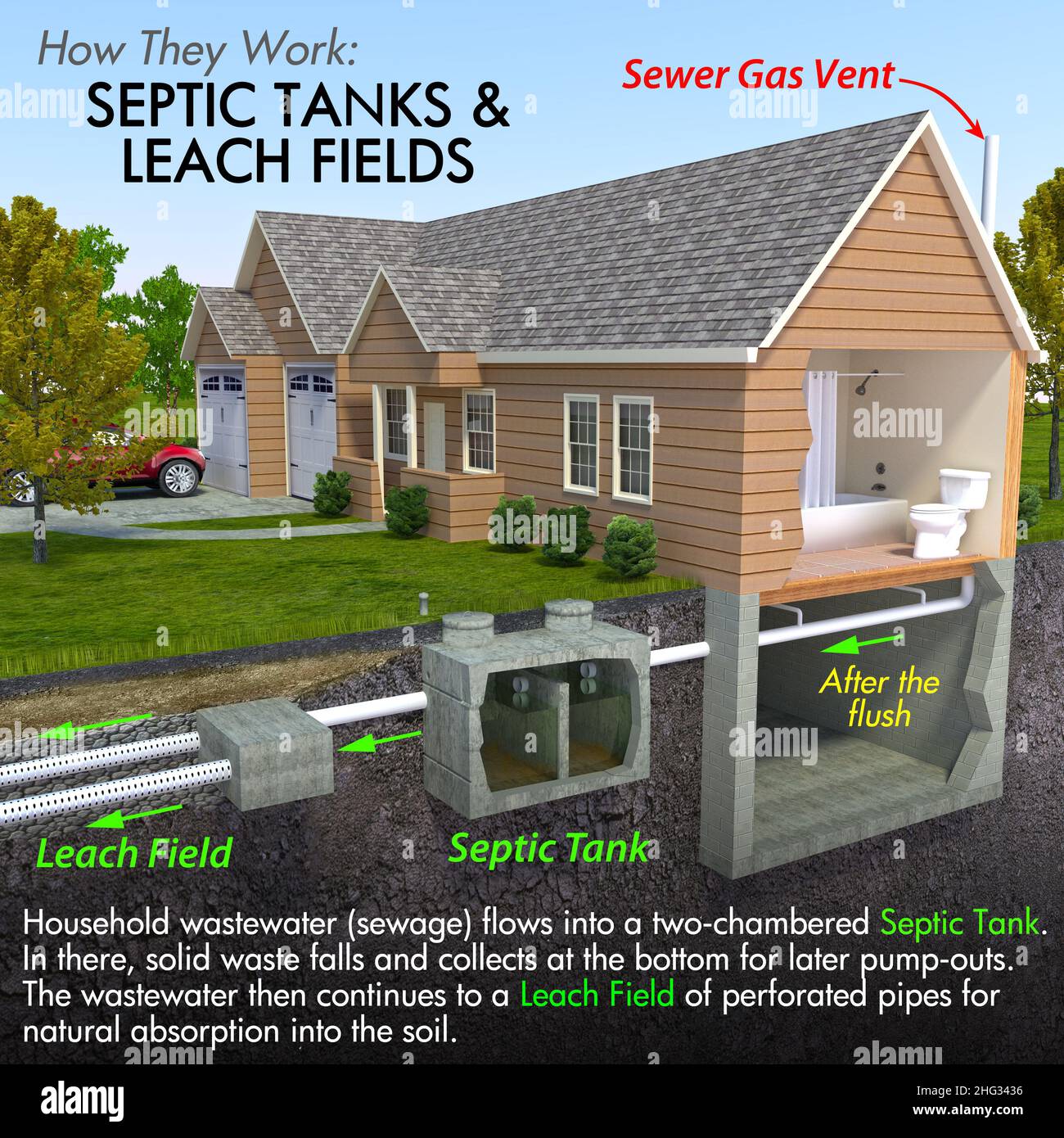 Septic bacteria hires stock photography and images Alamy