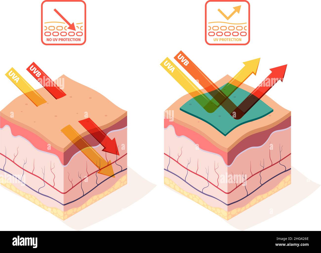 Sun uv protection. Human skin structure damage peel body layers 3d isometric technical