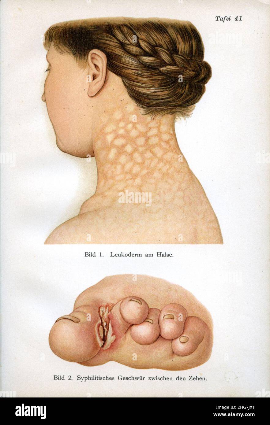 Siebert 24. Stock Photo