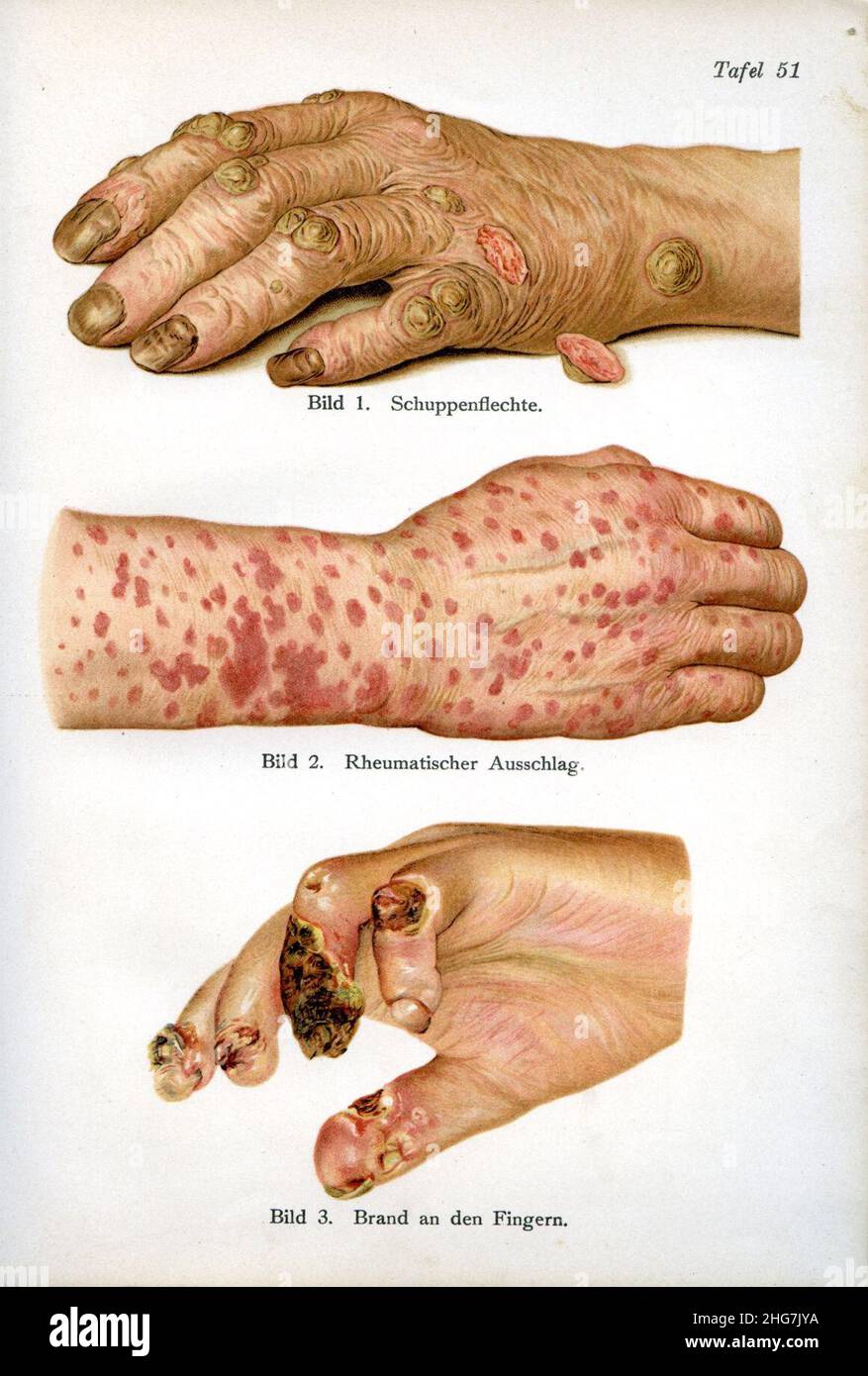 Siebert 29. Stock Photo