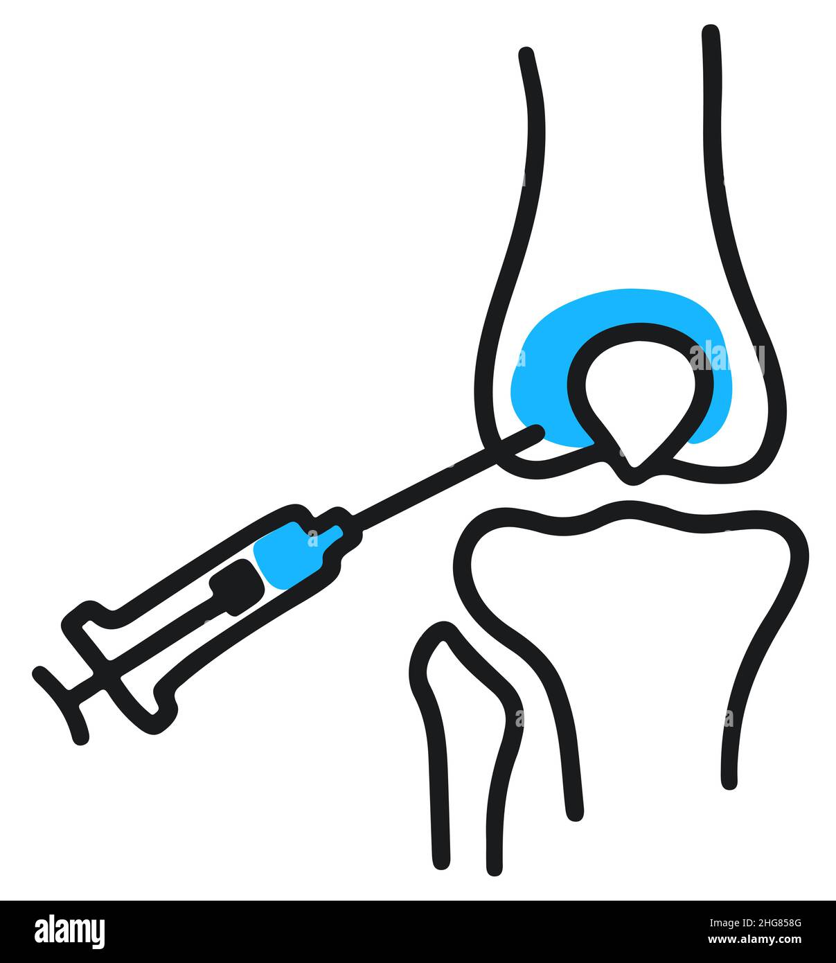 Injection into knee joint Doodle Outline vector illustration. Stock Vector