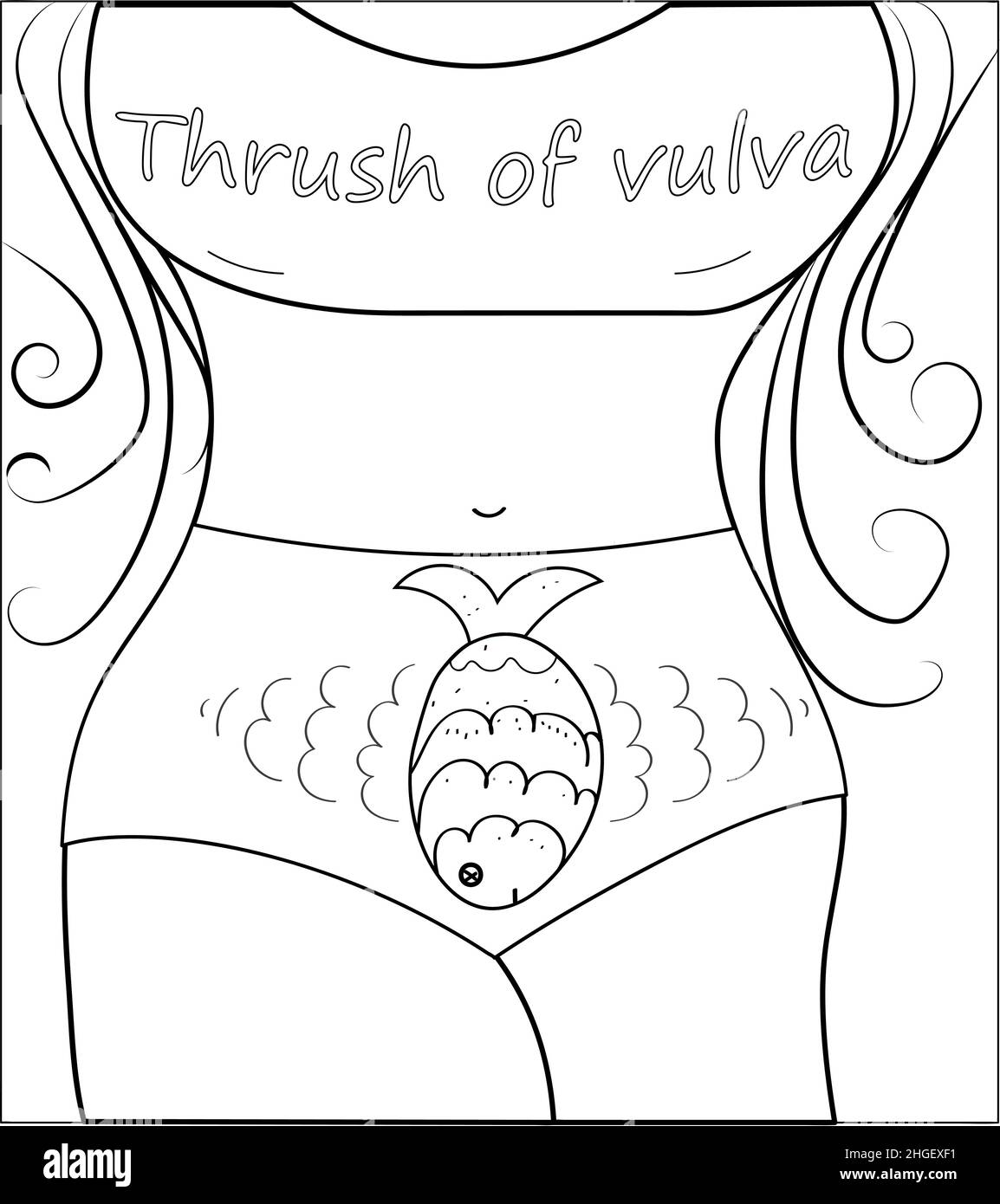 Vaginal thrush, candidiasis. Vaginal infection. Funny cartoon style  illustration Stock Vector Image & Art - Alamy