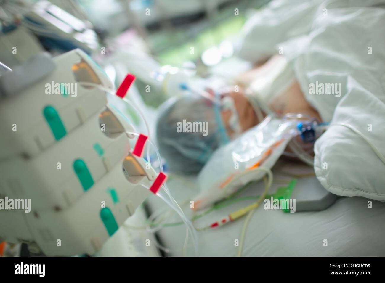 Critically ill patient under round the clock observation in intensive care. Stock Photo