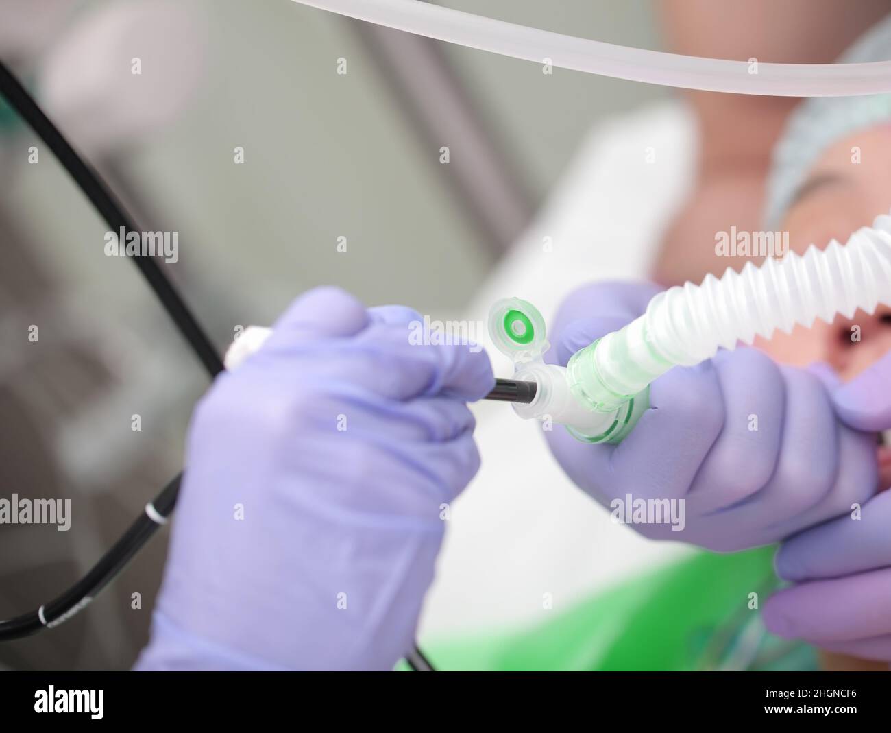 Group of medical workers conducting procedure of sanation the endotracheal tube of comatose patient. Stock Photo