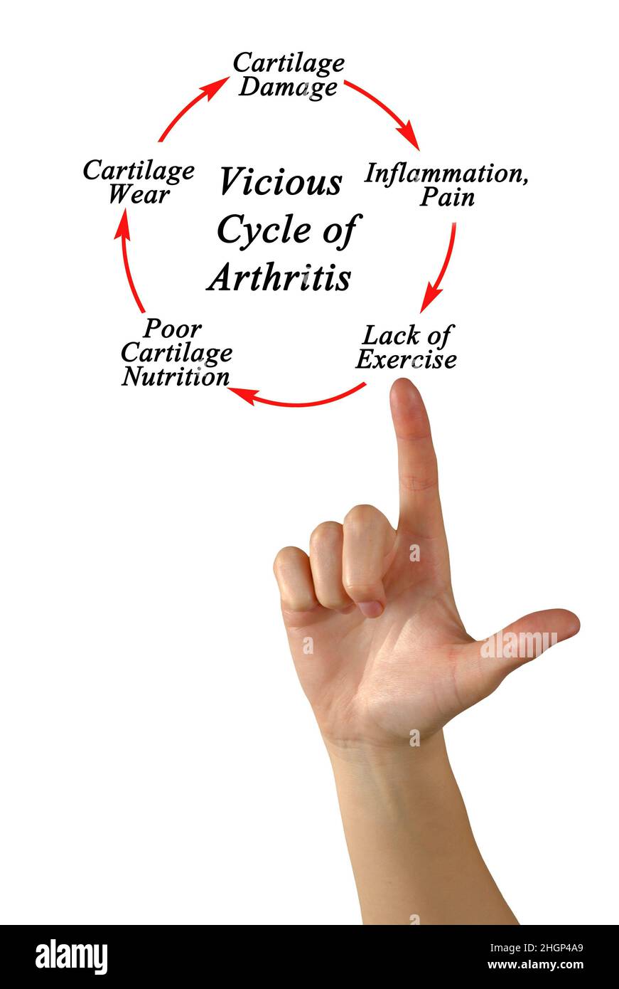 Steps in Vicious Cycle of Arthritis Stock Photo - Alamy